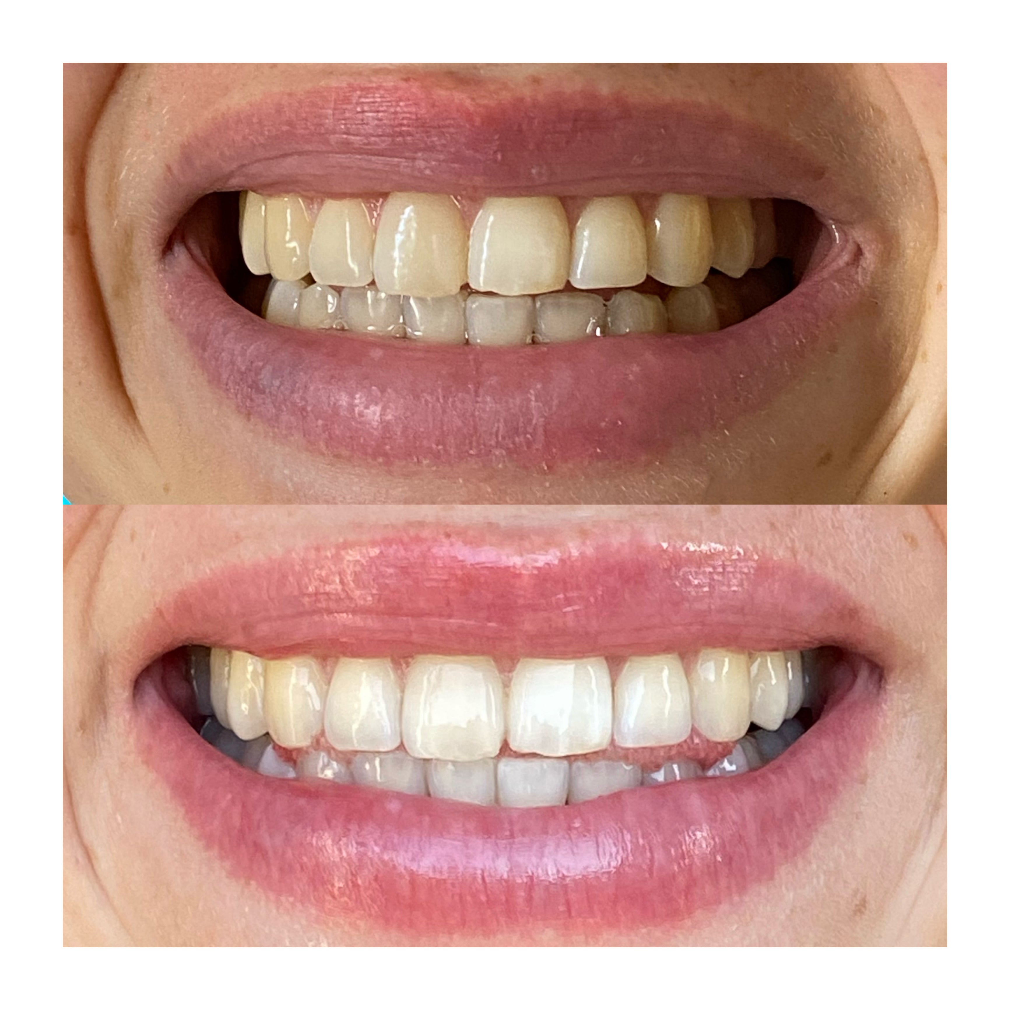 Natural Day & Night Toothpaste Duo | Organic Dental Care | Coco Clean